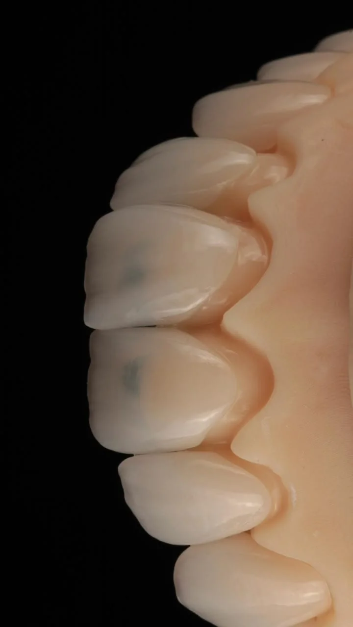 Detalhe de trabalho odontológico em porcelana